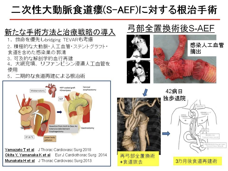 二次性大動脈食道瘻（S-AEF）に対する根治手術
